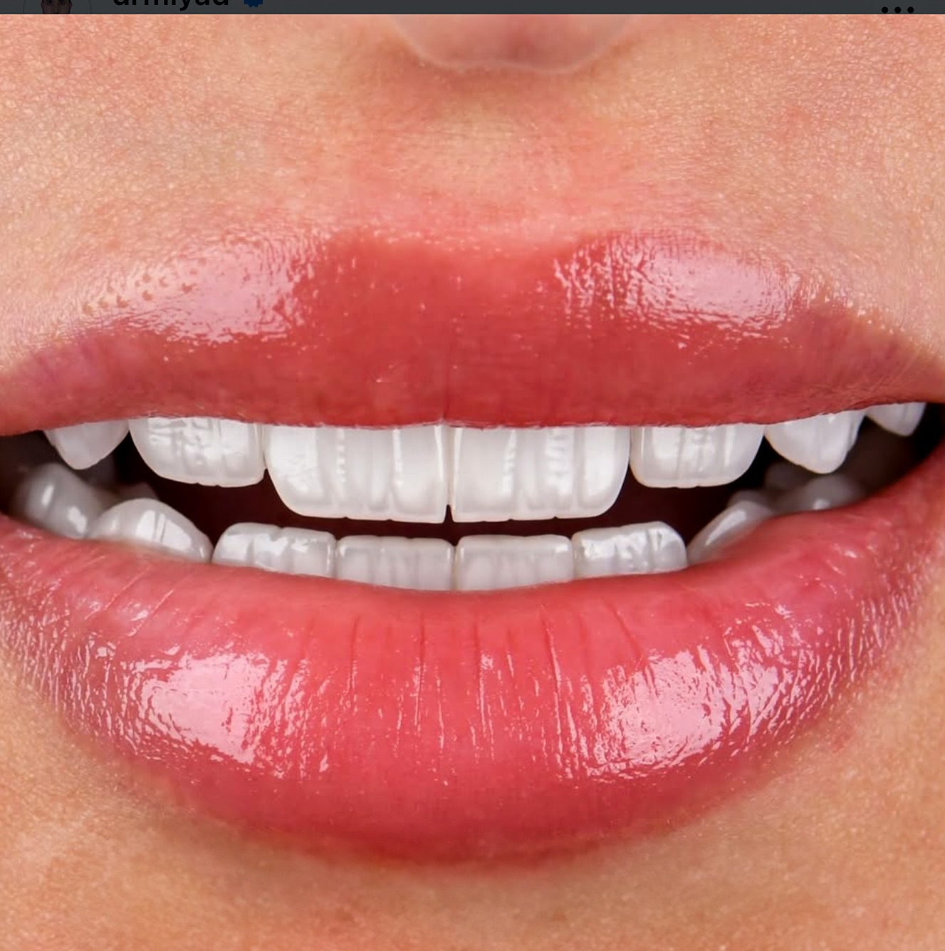 Dental laboratory workspace